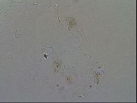 Echiniscoides sigismundi image