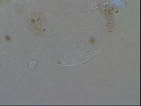 Echiniscoides sigismundi image