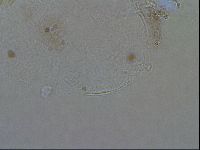 Echiniscoides sigismundi image