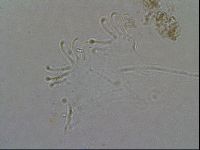 Echiniscoides sigismundi image
