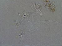 Echiniscoides sigismundi image
