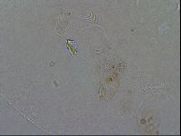 Echiniscoides sigismundi image