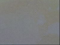 Echiniscoides sigismundi image