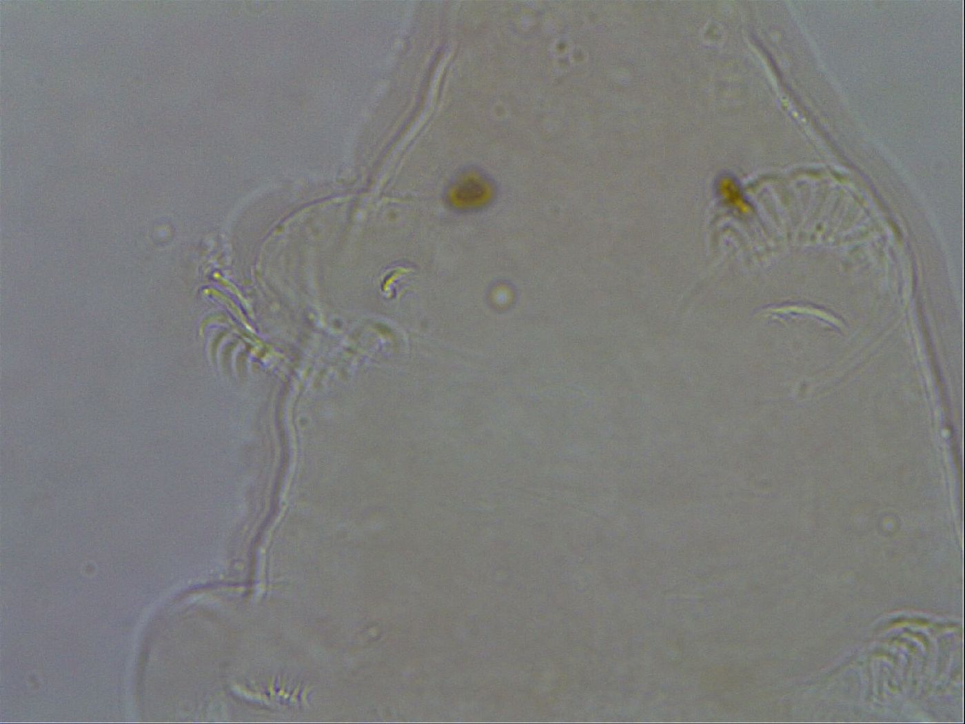 Echiniscoides image