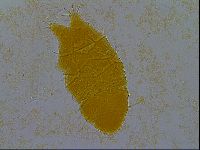 Echiniscus granulatus image