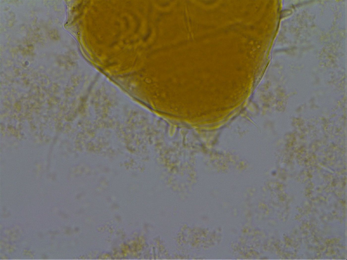 Echiniscus granulatus image