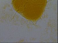 Media resource of Echiniscus granulatus