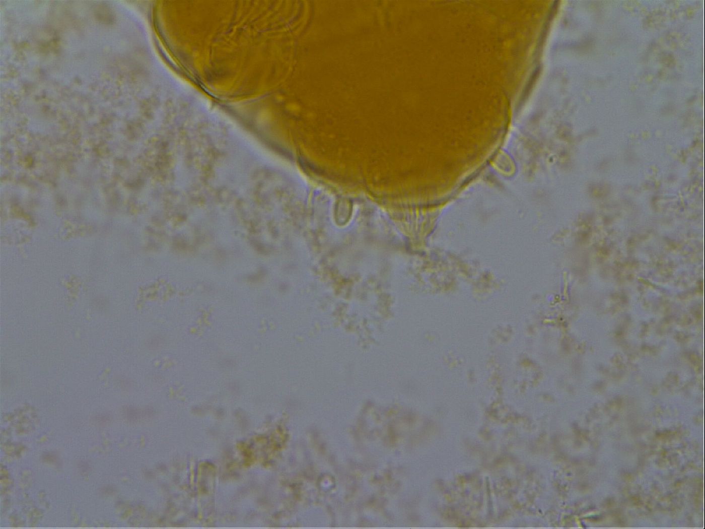 Echiniscus granulatus image