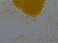 Echiniscus granulatus image