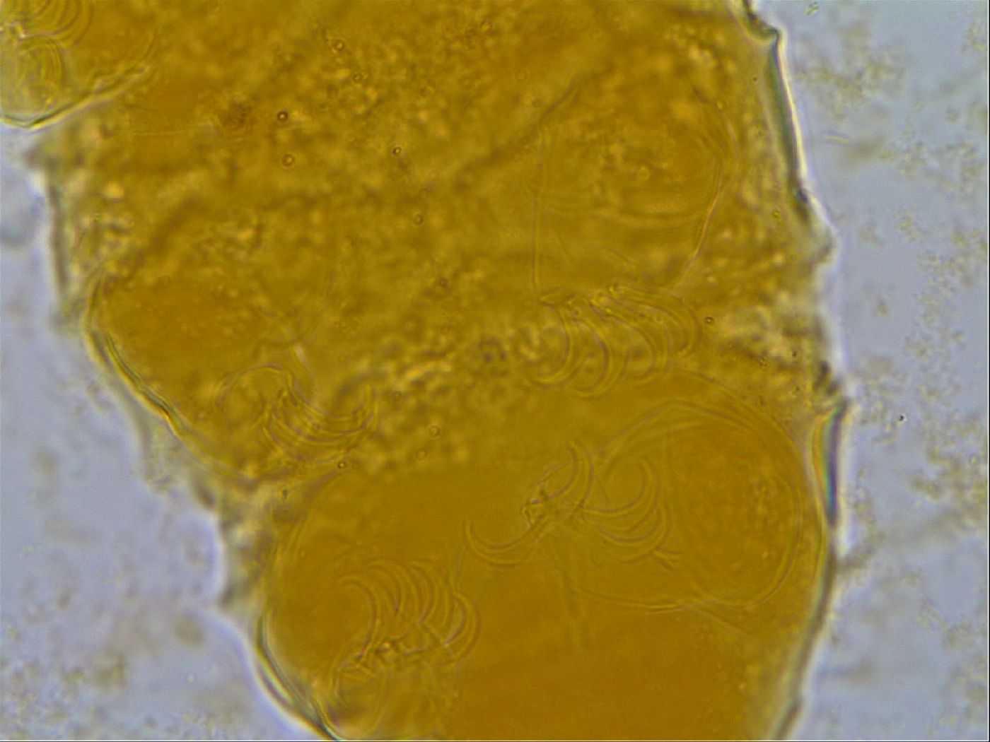 Echiniscus granulatus image