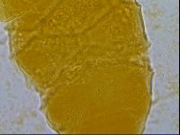Echiniscus granulatus image