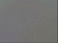 Echiniscus africanus image