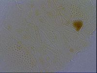 Echiniscus africanus image