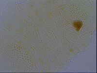 Echiniscus africanus image