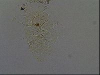 Echiniscus africanus image