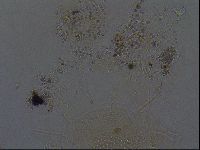 Echiniscus africanus image