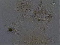 Echiniscus africanus image