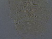 Echiniscus africanus image