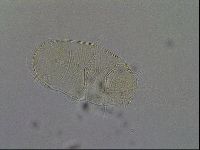 Echiniscus africanus image