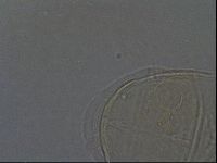 Echiniscus africanus image