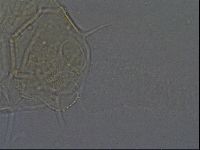 Media resource of Echiniscus africanus