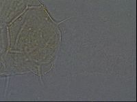 Echiniscus africanus image