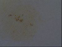 Echiniscus africanus image