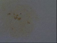 Echiniscus africanus image