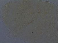 Echiniscus africanus image