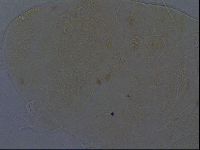 Echiniscus africanus image