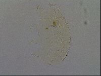 Echiniscus africanus image