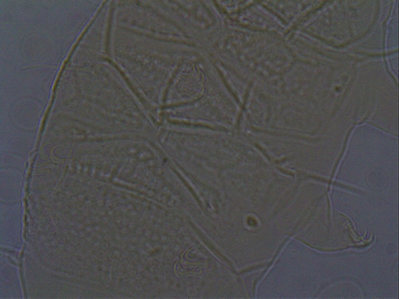 Echiniscus africanus image