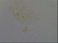 Echiniscus africanus image