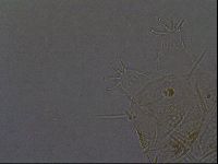 Echiniscus africanus image
