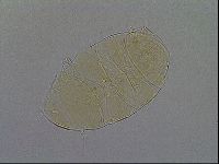 Echiniscus aliquantillus image