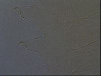Echiniscus aliquantillus image