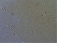 Echiniscus aliquantillus image