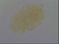 Echiniscus aliquantillus image