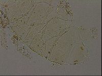 Echiniscus becki image
