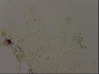 Echiniscus becki image