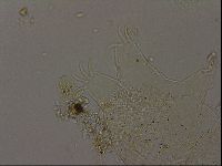 Echiniscus becki image
