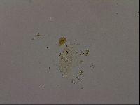 Echiniscus becki image