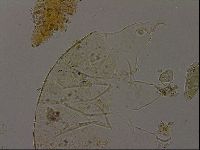 Echiniscus becki image
