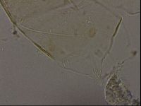 Echiniscus becki image