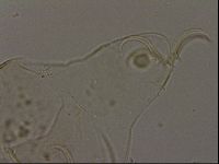 Echiniscus becki image