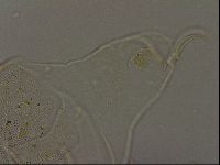 Echiniscus becki image