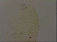 Echiniscus becki image
