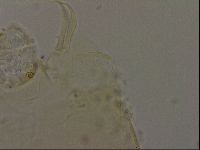 Echiniscus becki image