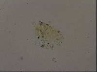 Echiniscus becki image