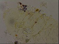Echiniscus becki image